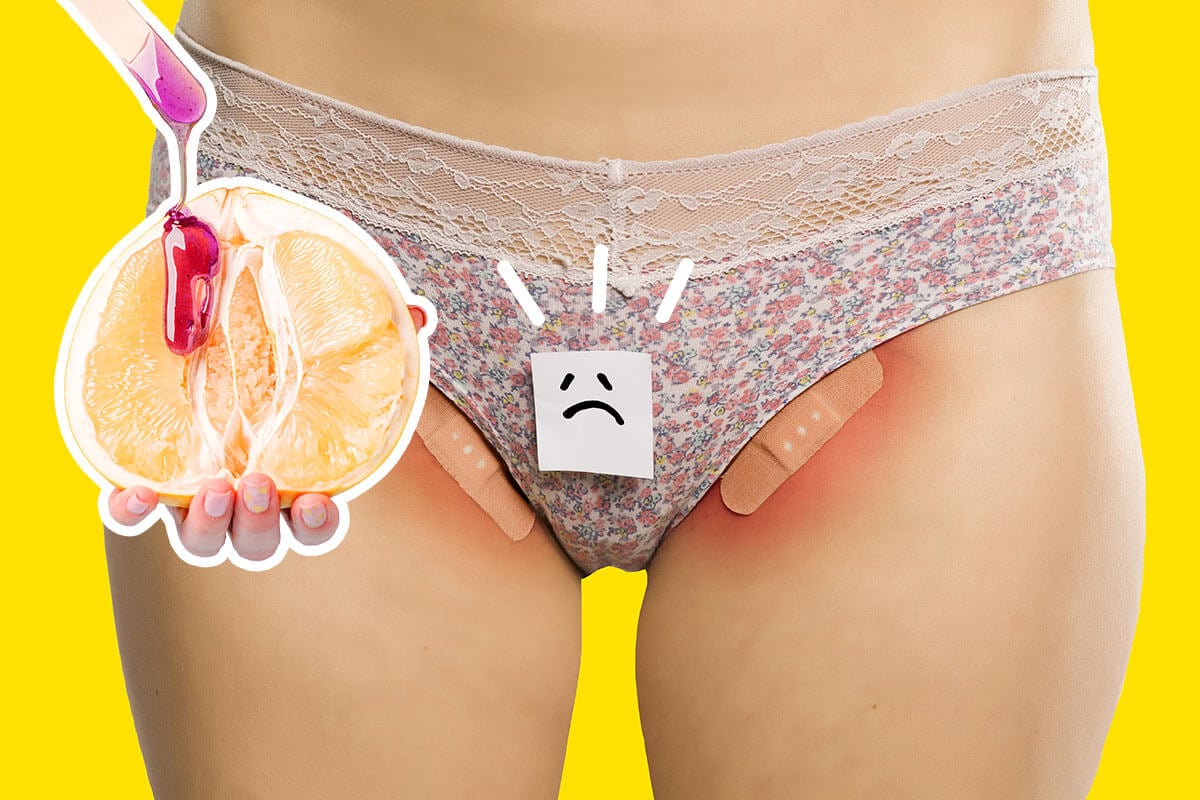 La depilazione è pericolosa