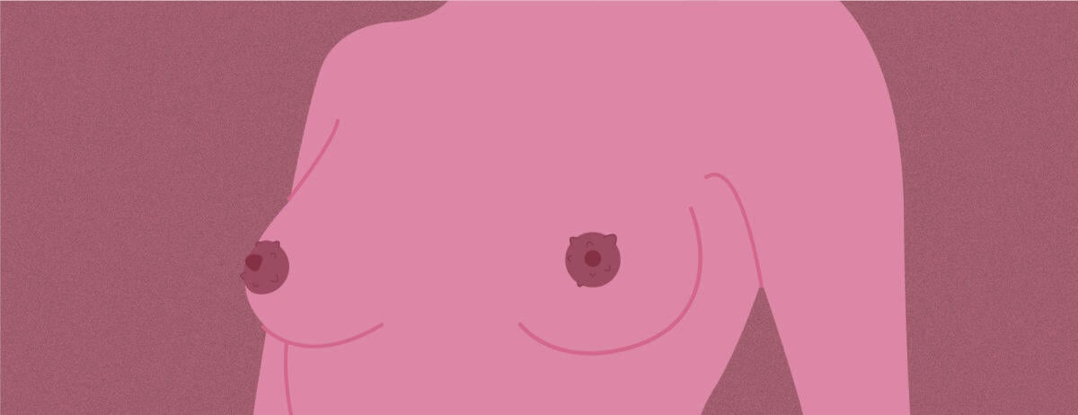 I capezzoli irregolari