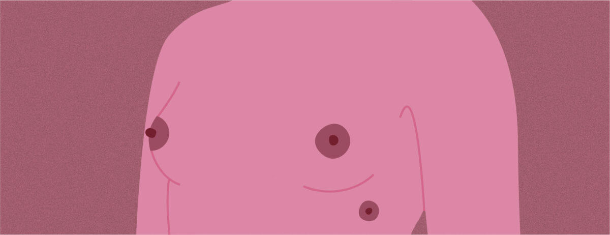 I capezzoli multipli